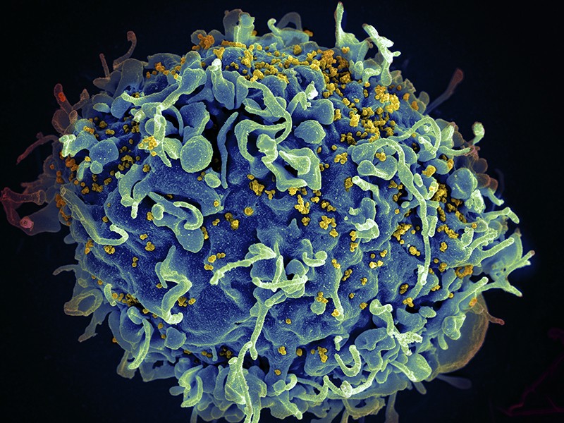 HIV Recovery: স্টেম সেল বদলে ফেলে এইডস মুক্তি!